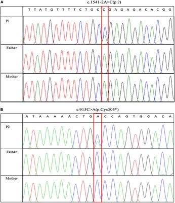 Two novel heterozygous truncating variants in NR4A2 identified in patients with neurodevelopmental disorder and brief literature review